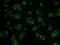 Hexokinase 2 antibody, NBP2-02272, Novus Biologicals, Immunocytochemistry image 