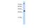 ISL LIM Homeobox 2 antibody, PA5-41670, Invitrogen Antibodies, Western Blot image 