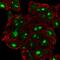 Diphthamine Biosynthesis 6 antibody, PA5-65952, Invitrogen Antibodies, Immunofluorescence image 