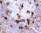 MER Proto-Oncogene, Tyrosine Kinase antibody, STJ113087, St John