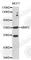 Matrix Metallopeptidase 2 antibody, A0317, ABclonal Technology, Western Blot image 