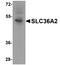 S36A2 antibody, TA355004, Origene, Western Blot image 