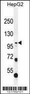 Collagen Type XXI Alpha 1 Chain antibody, 56-246, ProSci, Western Blot image 