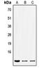 SEC61 Translocon Beta Subunit antibody, orb215549, Biorbyt, Western Blot image 