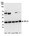 Ribosomal Protein L18 antibody, A305-341A, Bethyl Labs, Western Blot image 