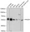 Phosphoglycerate Dehydrogenase antibody, GTX64499, GeneTex, Western Blot image 