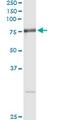 Arginyl Aminopeptidase antibody, MA5-19830, Invitrogen Antibodies, Immunoprecipitation image 