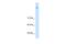 Neuronal Cell Adhesion Molecule antibody, A03746, Boster Biological Technology, Western Blot image 