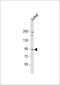 Nucleoporin 93 antibody, 61-246, ProSci, Western Blot image 