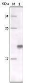 MER Proto-Oncogene, Tyrosine Kinase antibody, STJ98242, St John