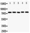 Tyrosine-protein kinase Tec antibody, PA5-80101, Invitrogen Antibodies, Western Blot image 