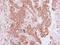 Pim-2 Proto-Oncogene, Serine/Threonine Kinase antibody, NBP1-33731, Novus Biologicals, Immunohistochemistry frozen image 