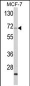 Zyg-11 Family Member A, Cell Cycle Regulator antibody, PA5-72552, Invitrogen Antibodies, Western Blot image 