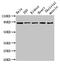 Semaphorin-3A antibody, LS-C671859, Lifespan Biosciences, Western Blot image 