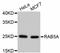 RAB5A, Member RAS Oncogene Family antibody, abx125387, Abbexa, Western Blot image 