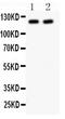 Neurotrophic Receptor Tyrosine Kinase 2 antibody, LS-C357568, Lifespan Biosciences, Western Blot image 