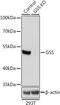 Glutathione Synthetase antibody, A00928, Boster Biological Technology, Western Blot image 
