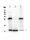 Trefoil Factor 3 antibody, A01738-2, Boster Biological Technology, Western Blot image 