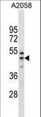 Ring Finger And FYVE Like Domain Containing E3 Ubiquitin Protein Ligase antibody, LS-C155984, Lifespan Biosciences, Western Blot image 