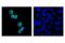 Hematopoietic Cell-Specific Lyn Substrate 1 antibody, 3892S, Cell Signaling Technology, Immunocytochemistry image 