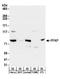Phosphofructokinase, Platelet antibody, A304-283A, Bethyl Labs, Western Blot image 
