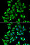 Ectonucleoside triphosphate diphosphohydrolase 2 antibody, STJ28667, St John