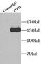 Tripeptidyl Peptidase 2 antibody, FNab08895, FineTest, Immunoprecipitation image 