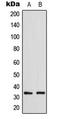 Growth Differentiation Factor 15 antibody, LS-C354139, Lifespan Biosciences, Western Blot image 