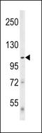 Unc-51 Like Autophagy Activating Kinase 1 antibody, LS-C167359, Lifespan Biosciences, Western Blot image 