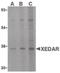 Ectodysplasin A2 Receptor antibody, LS-B562, Lifespan Biosciences, Western Blot image 