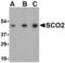 SCO Cytochrome C Oxidase Assembly Protein 1 antibody, TA306396, Origene, Western Blot image 