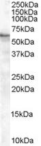 Brain-specific angiogenesis inhibitor 1-associated protein 2 antibody, EB05176, Everest Biotech, Western Blot image 