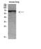 Keratin 2 antibody, STJ98693, St John