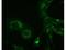 Replicase polyprotein 1a antibody, M19765, Boster Biological Technology, Immunocytochemistry image 