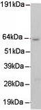 MUS81 Structure-Specific Endonuclease Subunit antibody, ab14387, Abcam, Western Blot image 