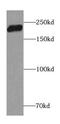 Centrosomal Protein 350 antibody, FNab01603, FineTest, Western Blot image 