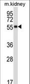 Somatostatin Receptor 1 antibody, LS-C161524, Lifespan Biosciences, Western Blot image 