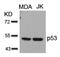 p53 antibody, 79-318, ProSci, Western Blot image 