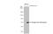 Dengue virus antibody, GTX124252, GeneTex, Western Blot image 