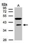 Ribonucleic Acid Export 1 antibody, NBP1-31027, Novus Biologicals, Western Blot image 