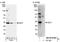 DnaJ Heat Shock Protein Family (Hsp40) Member C9 antibody, NB100-97848, Novus Biologicals, Western Blot image 