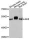 Adenylate Kinase 8 antibody, LS-C748793, Lifespan Biosciences, Western Blot image 