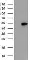 Spermine Synthase antibody, TA503101, Origene, Western Blot image 