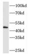 Meis Homeobox 3 antibody, FNab05111, FineTest, Western Blot image 