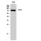 Eukaryotic Translation Initiation Factor 2 Alpha Kinase 2 antibody, LS-C385563, Lifespan Biosciences, Western Blot image 