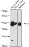 Protein Kinase C Delta antibody, 13-180, ProSci, Western Blot image 