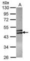 Zinc Finger Protein 439 antibody, PA5-31557, Invitrogen Antibodies, Western Blot image 