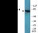 Protein Kinase C Theta antibody, EKC2203, Boster Biological Technology, Western Blot image 