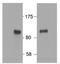 HIC ZBTB Transcriptional Repressor 1 antibody, AP32955PU-N, Origene, Western Blot image 