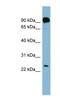 Proline Rich And Gla Domain 1 antibody, NBP1-59906, Novus Biologicals, Western Blot image 